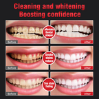 🦷SP-6 Probiotic Whitening and Stain-Removing Toothpaste (Exclusive to the U.S.)