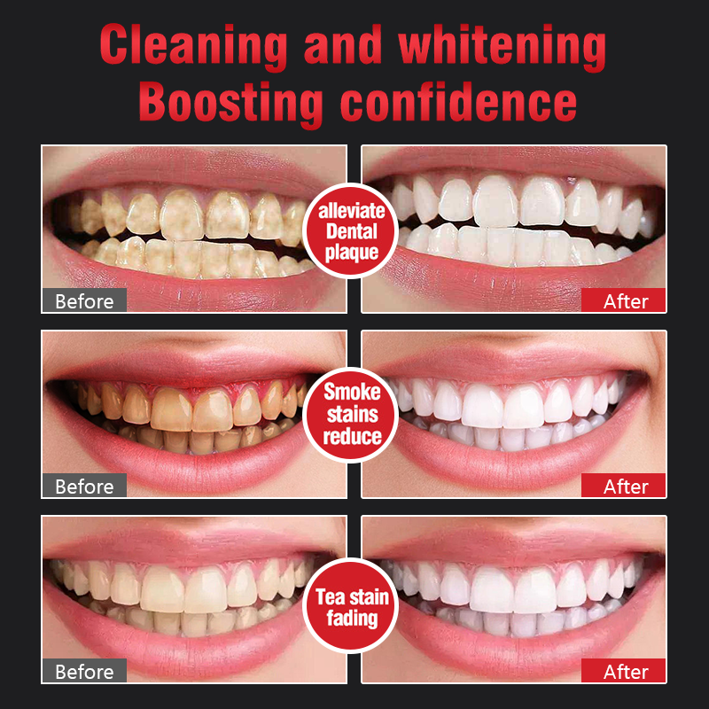 🦷SP-6 Probiotic Whitening and Stain-Removing Toothpaste (Exclusive to the U.S.)